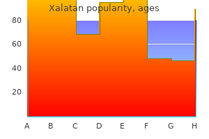 buy xalatan now