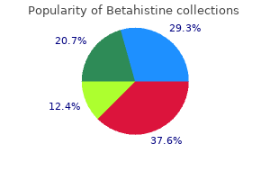order betahistine 16 mg with mastercard