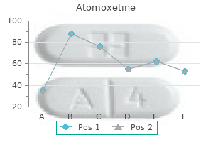 purchase atomoxetine 18mg line
