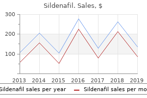 sildenafil 75 mg lowest price