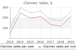 cheap clarinex express