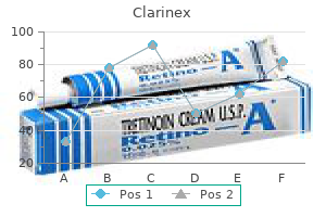 buy clarinex once a day