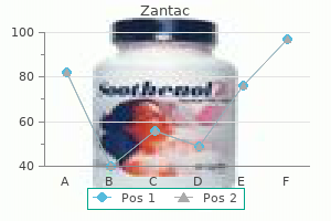 300 mg zantac sale